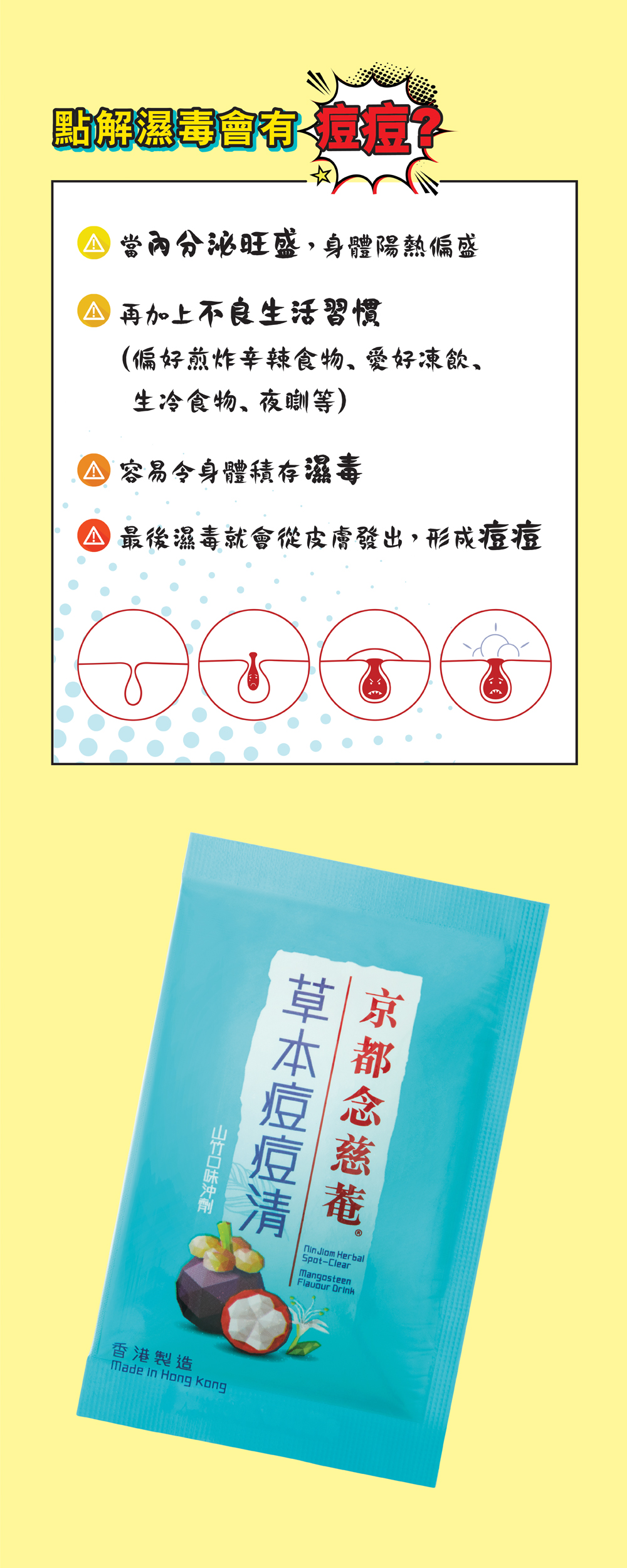 蒲公英
      金銀花 淡竹葉 清熱解毒 清熱解毒 清熱瀉火 梔子清熱利濕 荷葉 消暑化濕 決明子 清熱明目專為痘痘體質研製的獨有草本配方，*超過85%試用者同意改善痘痘，即沖即飲，方便好味。